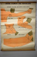 School poster - First aid for bleeding