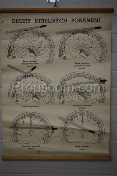 School poster - Types of gunshot wounds