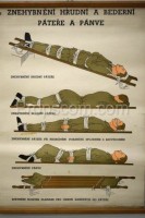 School poster - Immobilization of the spine