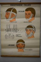 School poster - Jaw immobilization