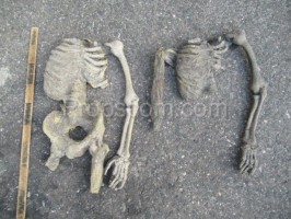 Teile menschlicher Skelettstützen