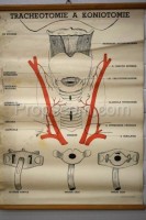 School poster - Tracheotomy and Coniotomy