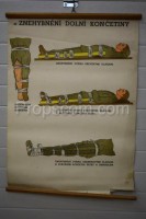 School poster - Immobilization of the lower limb