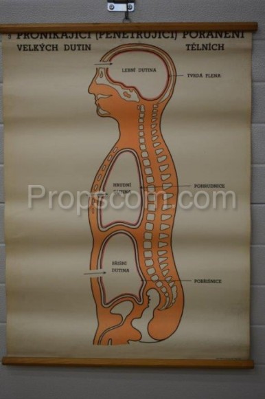 School poster - Penetrating injuries