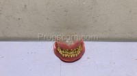 Dental prostheses