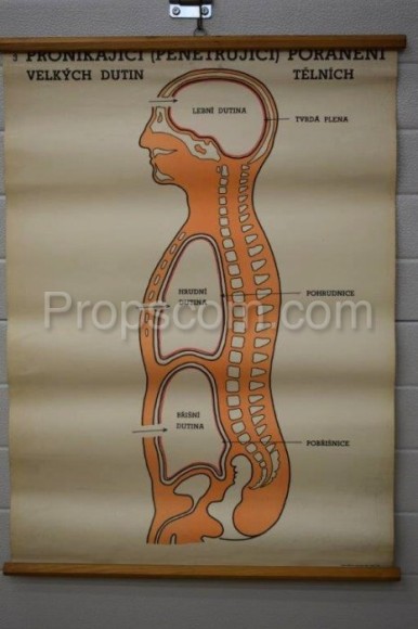 School poster - Penetrating injuries