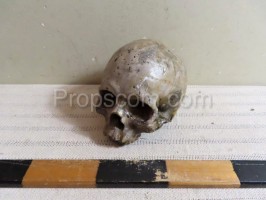 Human skull