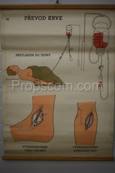 School poster - Blood transfer