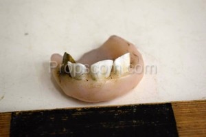 Artificial teeth