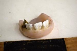 Künstliche Zähne