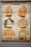 School poster - Immobilization of the key