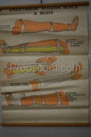 School poster - Immobilization of the knee