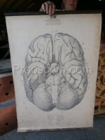 Brain anatomy - blind