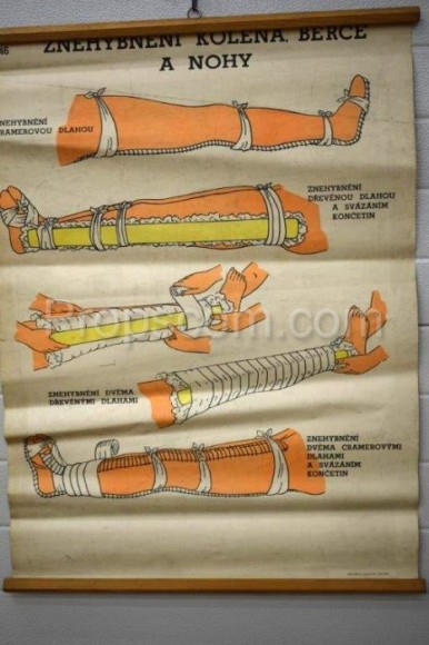 School poster - Immobilization of the knee